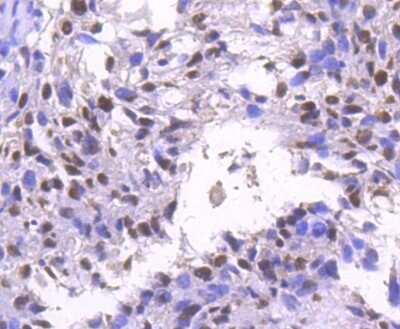 Immunohistochemistry: Brg1 Antibody (SN20-03) [NBP2-74964]
