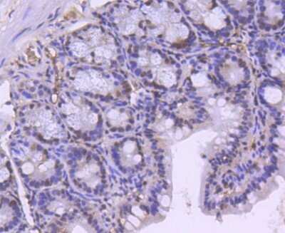 Immunohistochemistry: Brg1 Antibody (SN20-03) [NBP2-74964]