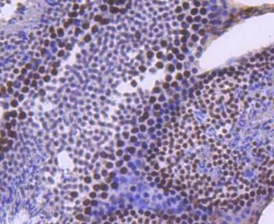 Immunohistochemistry: Brg1 Antibody (SN20-03) [NBP2-74964]