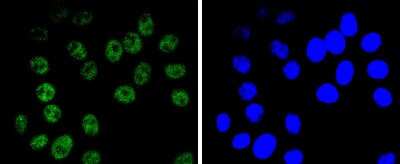 Immunocytochemistry/ Immunofluorescence: Brg1 Antibody (SN20-03) [NBP2-67720]