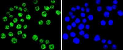 Immunocytochemistry/ Immunofluorescence: Brg1 Antibody (SN20-03) [NBP2-67720]