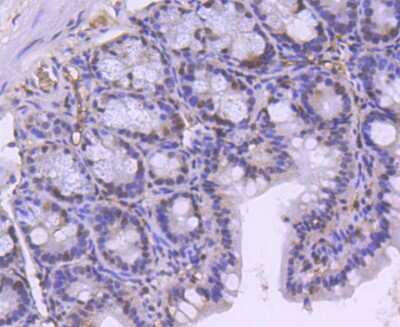Immunohistochemistry-Paraffin: Brg1 Antibody (SN20-03) [NBP2-67720]