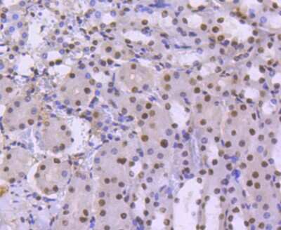 Immunohistochemistry-Paraffin: Brg1 Antibody (SN20-03) [NBP2-67720]