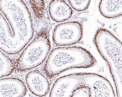 Immunohistochemistry-Paraffin: Brg1 Antibody (SN20-03) [NBP2-67720]