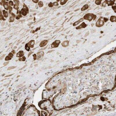 Immunohistochemistry: Brk Antibody [NBP1-89936]