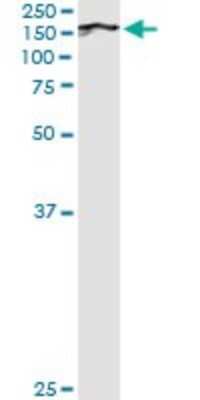 Immunoprecipitation: Bub1 Antibody (2F9) [H00000699-M02]