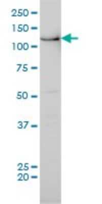 Western Blot: Bub1 Antibody (2F9) [H00000699-M02]
