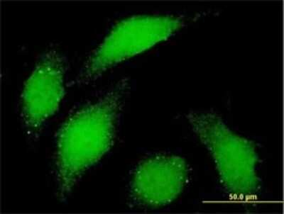 Immunocytochemistry/ Immunofluorescence: Bub1 Antibody (4C3-4C9) [H00000699-M01]