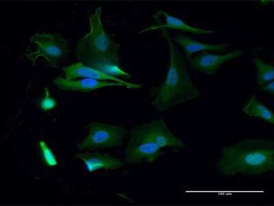 Immunocytochemistry/ Immunofluorescence: Bub1 Antibody [H00000699-D01P]