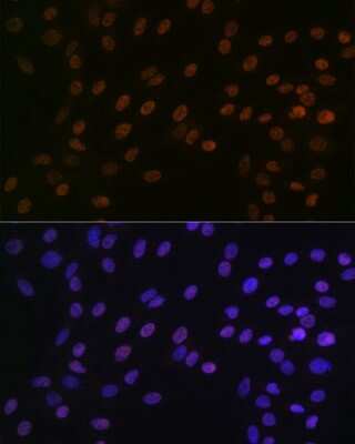 Immunocytochemistry/ Immunofluorescence: Bub3 Antibody (10G1S6) [NBP3-16709]