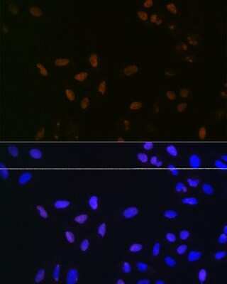 Immunocytochemistry/ Immunofluorescence: Bub3 Antibody (10G1S6) [NBP3-16709]