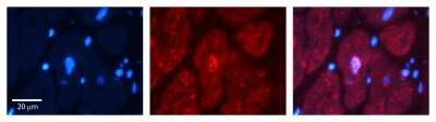 Immunohistochemistry: Bub3 Antibody [NBP1-58206]
