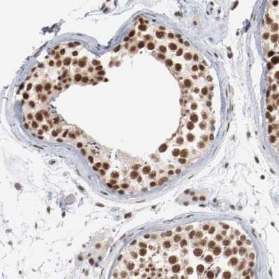 Immunohistochemistry-Paraffin: Bub3 Antibody [NBP1-88517]
