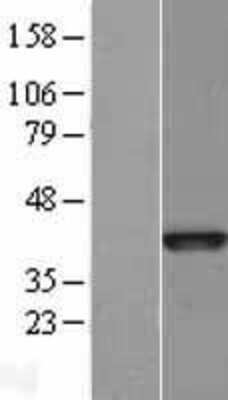 Western Blot: Bub3 Overexpression Lysate [NBP2-09808]