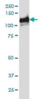 Western Blot: BubR1 Antibody (2G5) [H00000701-M02]