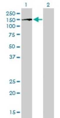 Western Blot: BubR1 Antibody (2G5) [H00000701-M02]