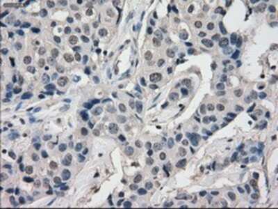 Immunohistochemistry-Paraffin: BubR1 Antibody (OTI6E5) [NBP1-47680]
