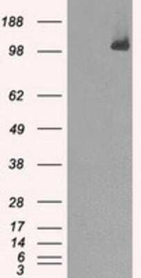 Western Blot: BubR1 Antibody (OTI6E5) [NBP1-47680]