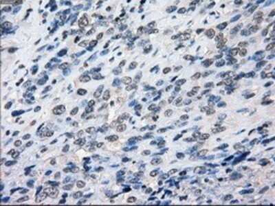 Immunohistochemistry: BubR1 Antibody (OTI6E5) - Azide and BSA Free [NBP2-70314]