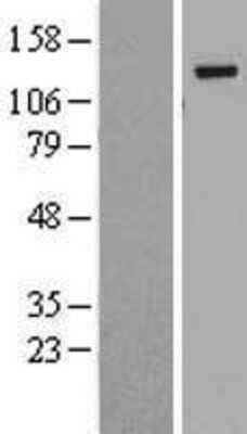 Western Blot: BubR1 Overexpression Lysate [NBL1-08057]