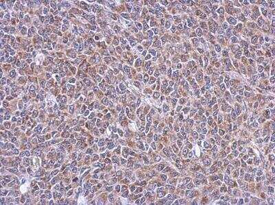 Immunohistochemistry-Paraffin: Buster3 Antibody [NBP2-15630]