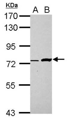 Western Blot: Buster3 Antibody [NBP2-15630]