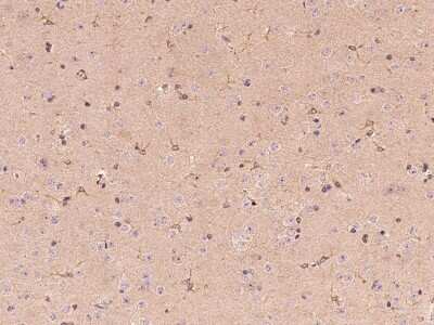 Immunohistochemistry-Paraffin: Butyrylcholinesterase/BCHE Antibody [NBP2-98275]