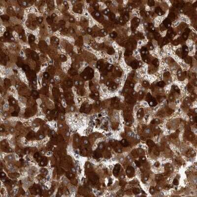 Immunohistochemistry-Paraffin: C-Reactive Protein/CRP Antibody [NBP1-87183]