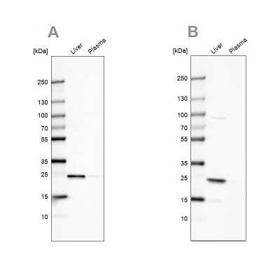 Western Blot: C-Reactive Protein/CRP Antibody [NBP1-87183]