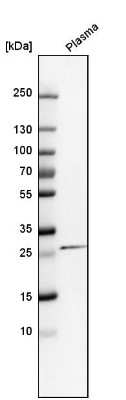 Western Blot: C-Reactive Protein/CRP Antibody [NBP1-87184]