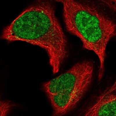 Immunocytochemistry/ Immunofluorescence: LRMDA Antibody [NBP2-14370]