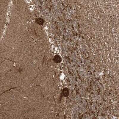 Immunohistochemistry-Paraffin: C10orf113 Antibody [NBP1-90831]