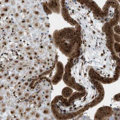 Immunohistochemistry-Paraffin: CCDC186 Antibody [NBP1-90441]