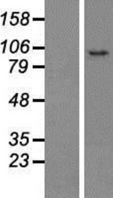Western Blot: CCDC186 Overexpression Lysate [NBP2-06886]