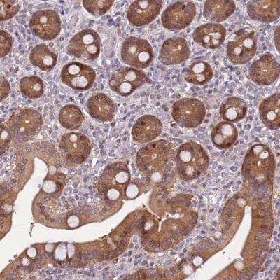 Immunohistochemistry: CC2D2B Antibody [NBP2-30772]
