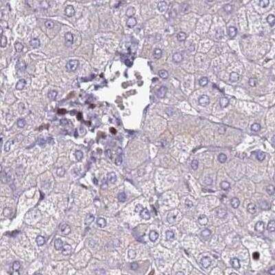 Immunohistochemistry: CC2D2B Antibody [NBP2-30772]