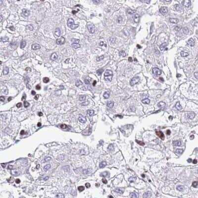 Immunohistochemistry: CC2D2B Antibody [NBP2-30772]