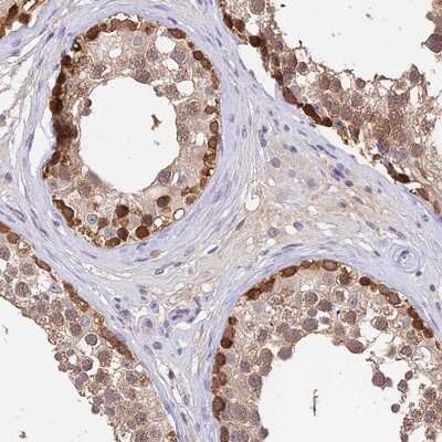 Immunohistochemistry-Paraffin: C10orf55 Antibody [NBP1-91710]