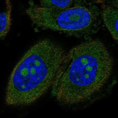 Immunocytochemistry/ Immunofluorescence: CCDC7 Antibody [NBP2-58012]
