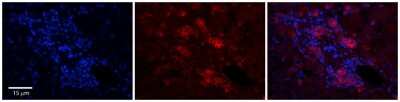 Immunohistochemistry-Paraffin: C11orf24 Antibody [NBP2-82814]