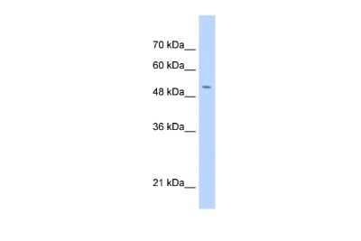 Western Blot: C11orf24 Antibody [NBP2-82814]