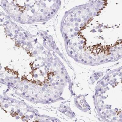 Immunohistochemistry: C11orf42 Antibody [NBP2-38028]