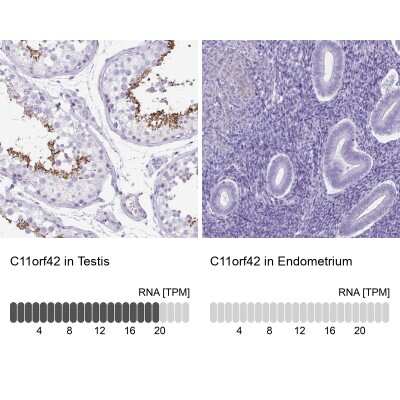 Immunohistochemistry-Paraffin: C11orf42 Antibody [NBP2-38028]
