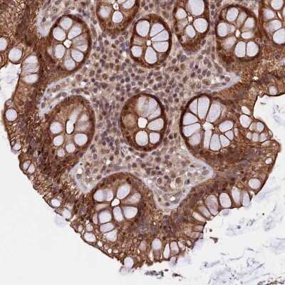 Immunohistochemistry-Paraffin: ARL14EP Antibody [NBP2-48712]