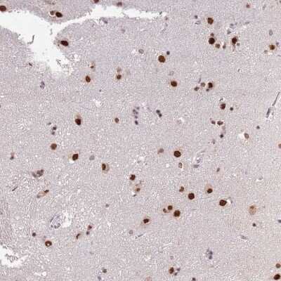 Immunohistochemistry-Paraffin: ARL14EP Antibody [NBP2-48890]