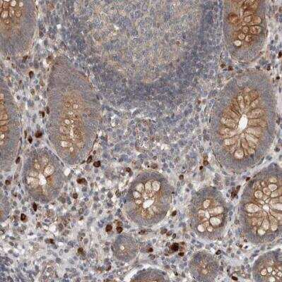 Immunohistochemistry-Paraffin: LBHD1 Antibody [NBP1-81155]