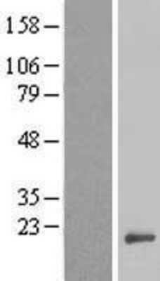 Western Blot: ANAPC15 Overexpression Lysate [NBL1-08107]