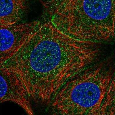 Immunocytochemistry/ Immunofluorescence: C11orf52 Antibody [NBP1-82060]