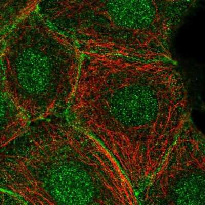 Immunocytochemistry/ Immunofluorescence: C11orf52 Antibody [NBP2-38409]