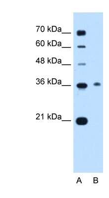 Western Blot: C11orf54 Antibody [NBP1-56904]